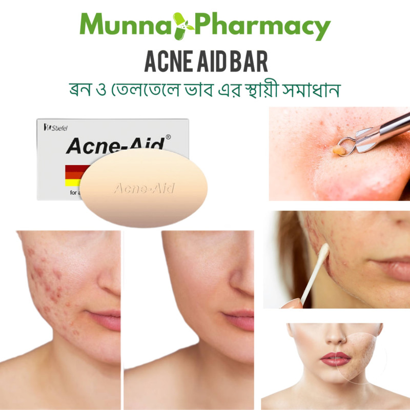 Acne-Aid Bar 100g Pimple Prone & Oily Skin Acne Aid Soap