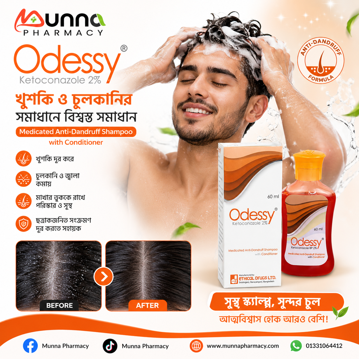 Odessy ketokonazole 60 ml
